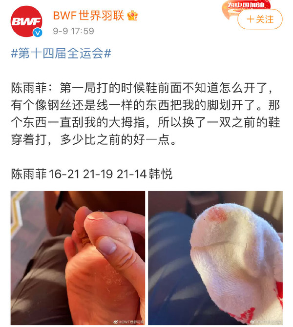 奥运冠军陈雨菲全运会穿李宁鞋比赛脚被割伤 疑似大脚指被“钢丝”戳到